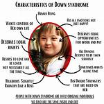 A Window into Down Syndrome