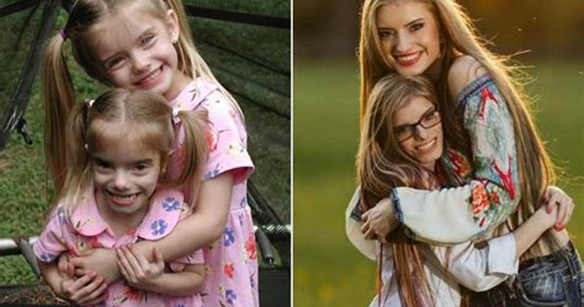 Are the Johnston Twins Affected by Dwarfism?
