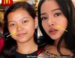Bella Poarch | Plastic Surgery Before and After