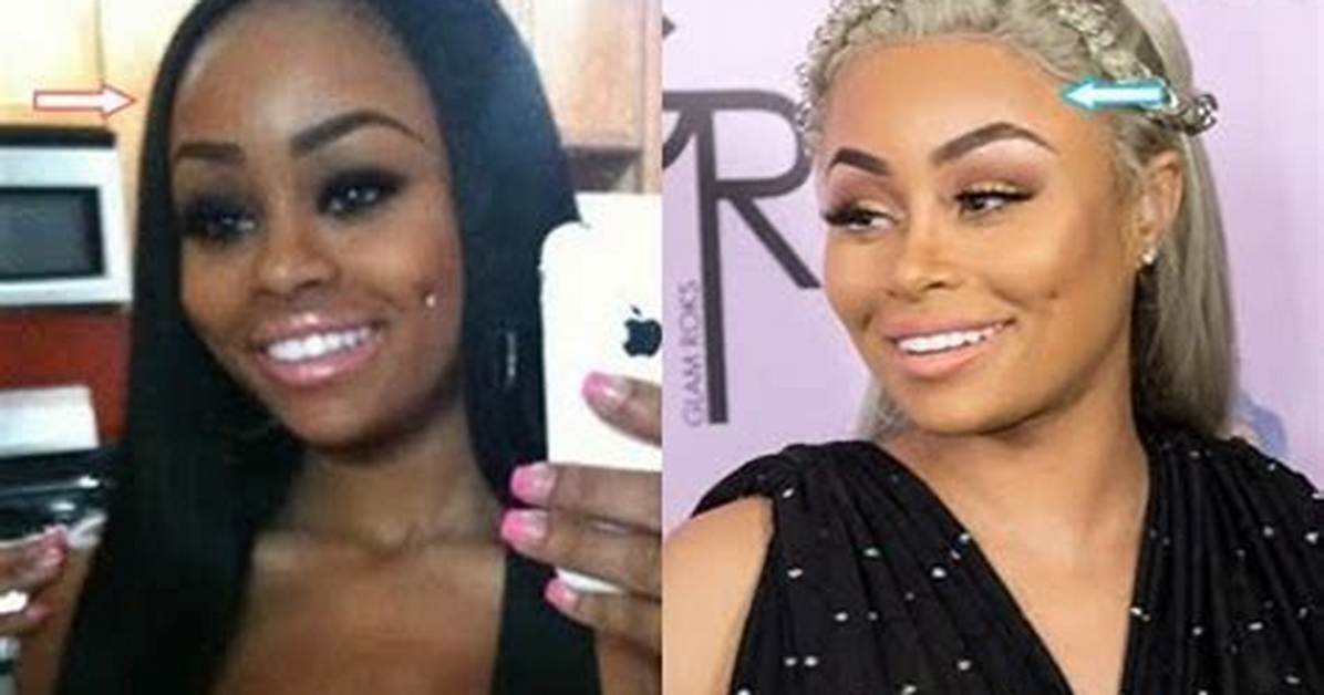 Blac Chyna Before Bleaching Her Skin and Surgery Age Height and Instagram