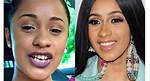 Cardi B Teeth Fixed Before and After: a Comprehensive Look
