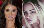 Chloe Sims Shocking Surgery Transformation in Pics See the Towie Star Before and After T ·