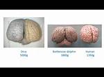 Comparing an Orca's Brain to a Human's Explains Why Killer Whales Are the Ocean's Ultimate Apex Pred