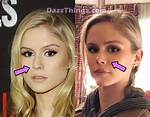 Did Erin Moriarty's Nose Job Transform Her Face?