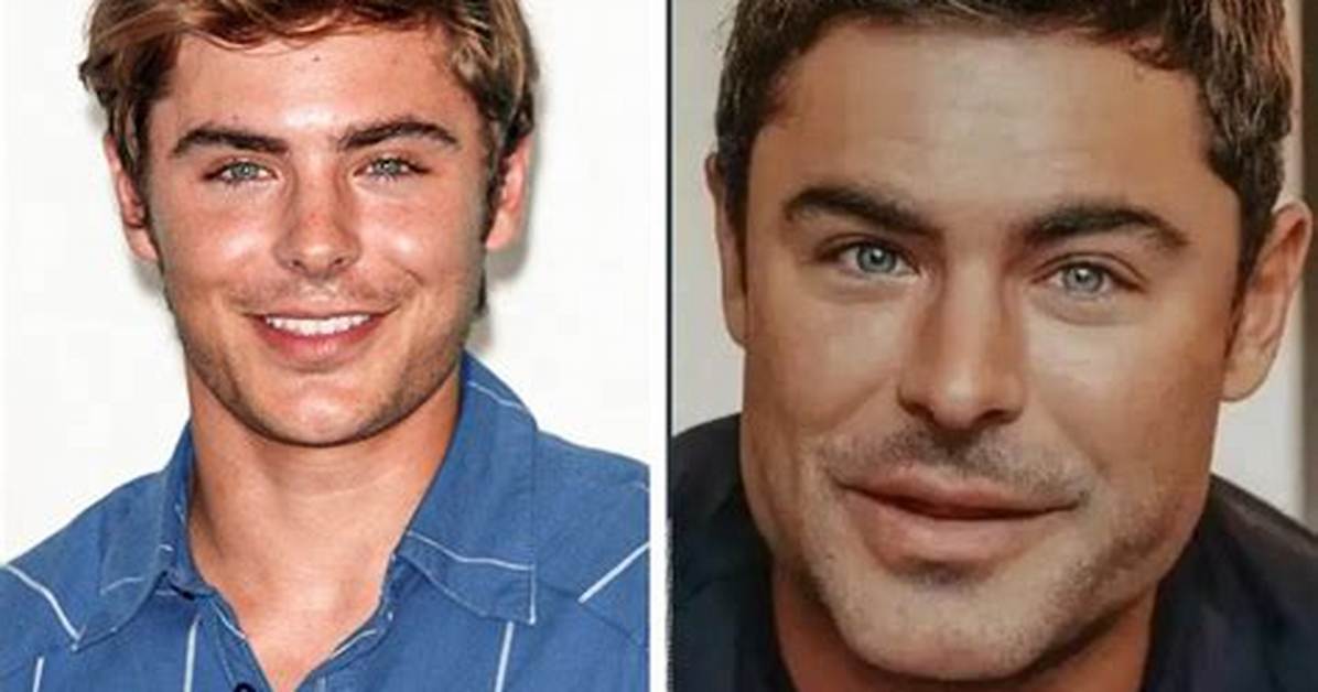 Did He Get Surgery? Before and After Pics, Age and Height |