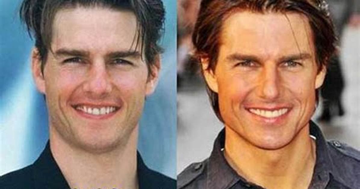Did Tom Cruise Get a Nose Job?