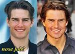 Did Tom Cruise Get a Nose Job?
