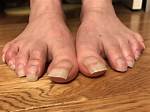 Discover the Secrets of Big Natural Toes: Unlocking Health and Beauty