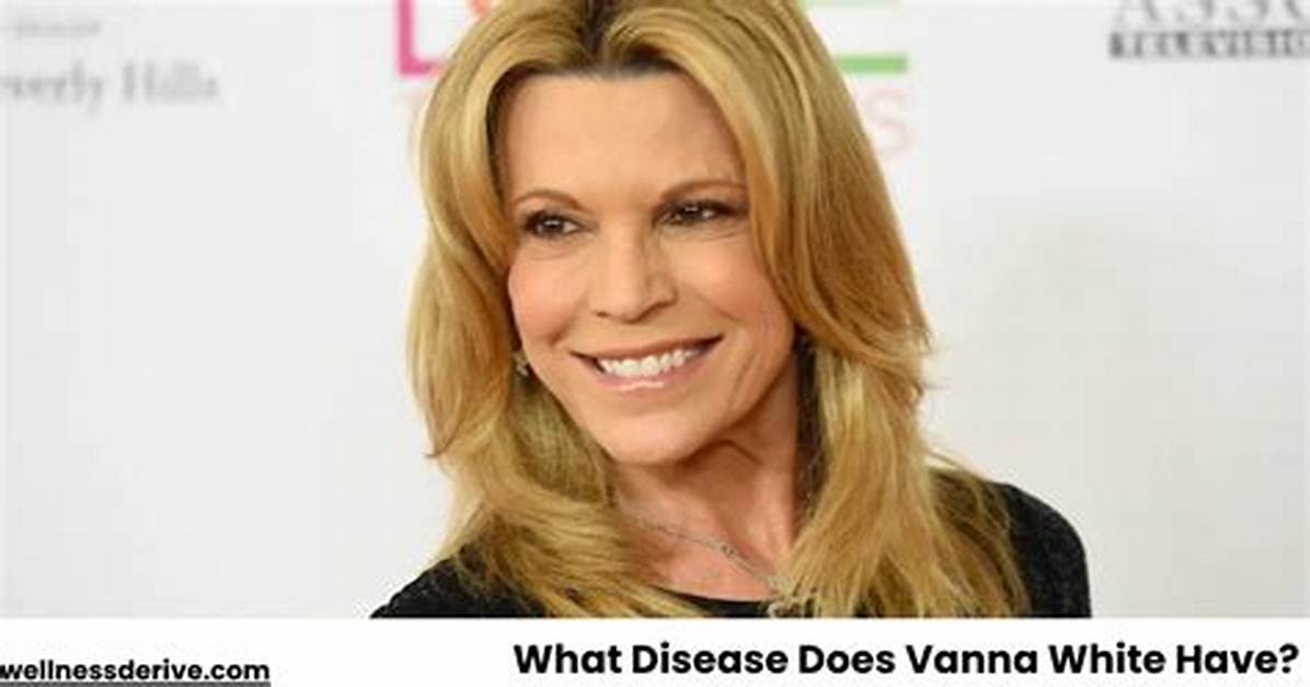 Does Vanna White Have Grandchildren? a Comprehensive Look into Her Family Life