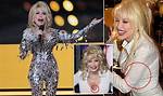 Dolly Parton Admitted She Has Tattoos to Cover "Scars and Things" |