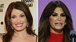 Exploring the Allure of Kimberly Guilfoyle Lip Filler: Beauty and Beyond