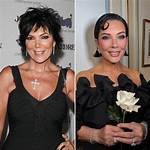Gio Helou Mom Plastic Surgery: a Journey of Transformation