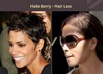 Halle Berry Hair Loss Struggles