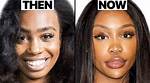 Has Sza Had Plastic Surgery? Fans Weigh In