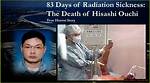 Hisashi Ouchi Real Photo: Understanding the Tragic Story Behind the Image