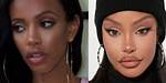 How Jodie Joe Changed After Her Surgery?