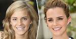 How the Smiles of 15 Celebrities Changed After They Fixed Their Teeth