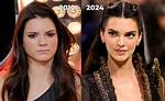 Kendall's Incredible Transformation: Before and After