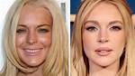 Lindsay Lohan's Face Transformation: Uncovering the Truth