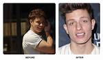 Matt Rife's Dental Journey Unveiled