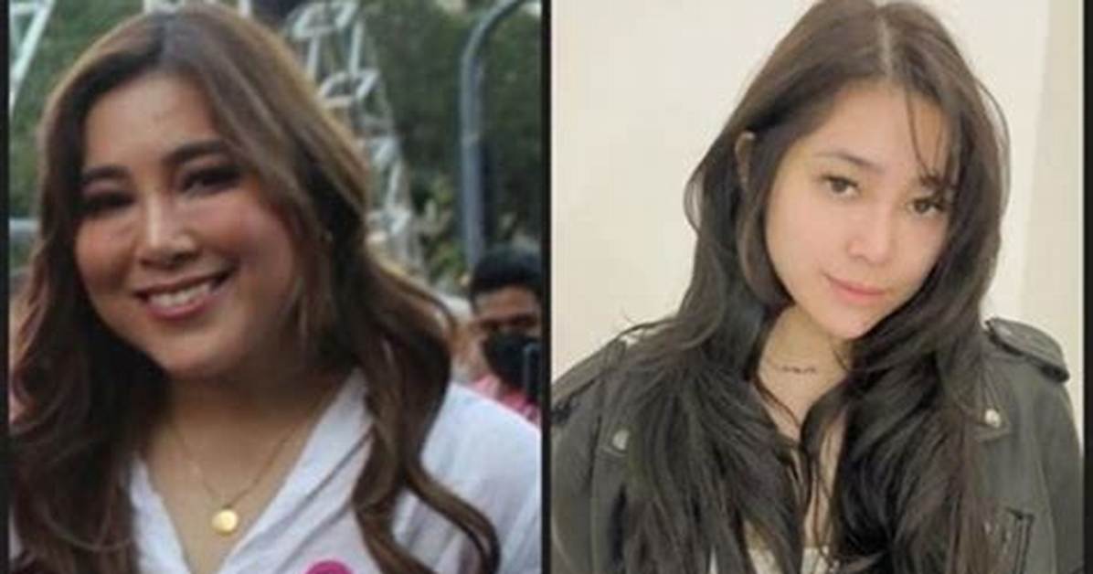 Moira Dela Torre | Before and After Surgery and New Look