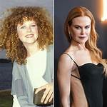 Nicole Kidman: the Transformation Through Facelifts