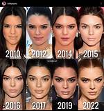 Plastic Surgery Before and After