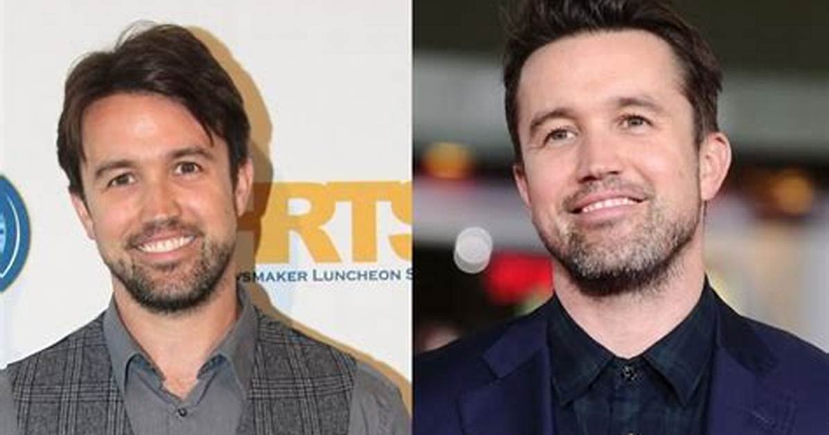 Rob Mcelhenney Plastic Surgery Before and After