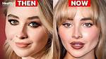 Sabrina Carpenter's Journey Through Surgery: What We Know