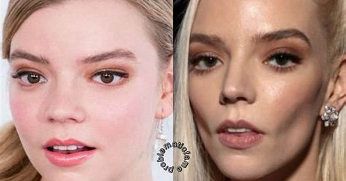 Secrets, Surgeries, and Instagram Fame