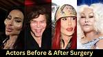 Shows off Recent Surgery Hollywood Life