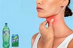 Sprite for Sore Throats: Does It Work?