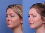 Surgery Before and After |