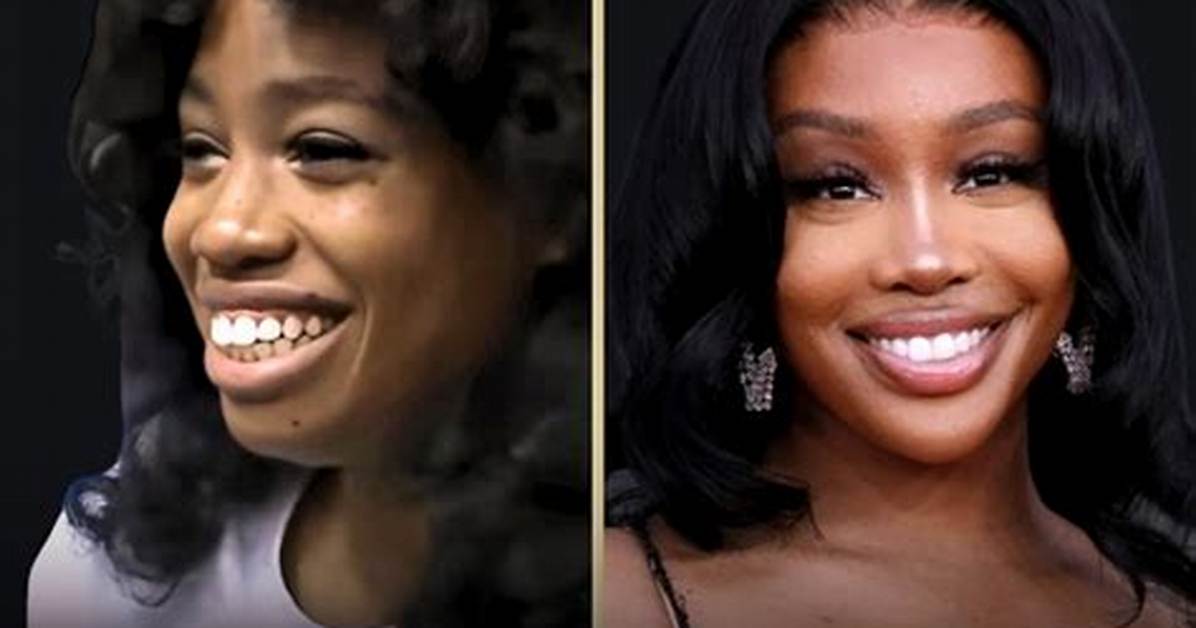 Sza Nose: a Comprehensive Look into Her Distinctive Feature