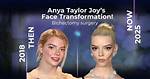 Truth About Anya Taylor-Joys Plastic Surgery Rumors| Her Beauty Treatment Based on Quotes & Photo