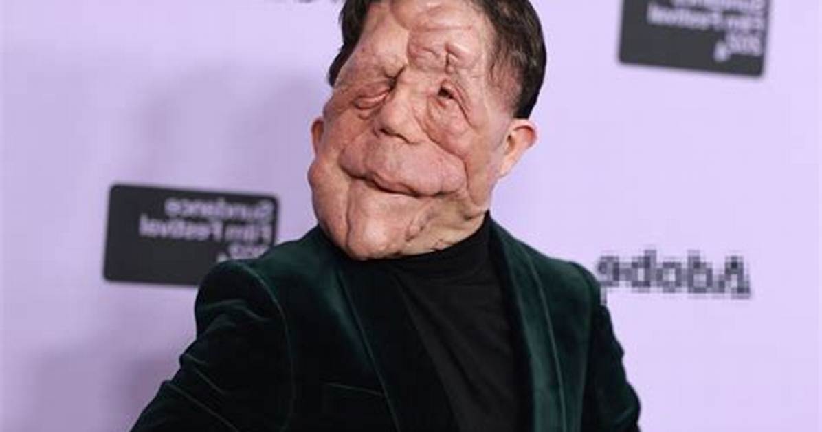 Understanding Adam Pearson's Girlfriend: a Deep Dive into His Personal Life