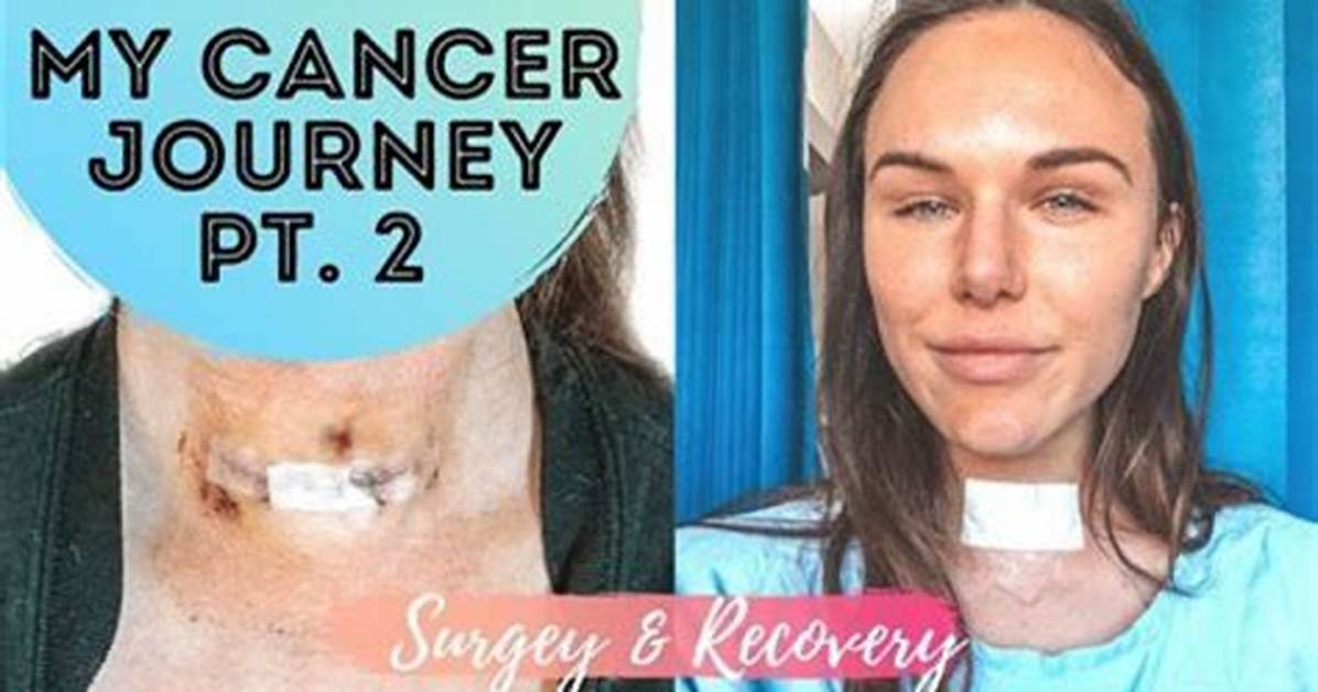 Unlocking the Thyroid Cancer Journey with Joyce Vance