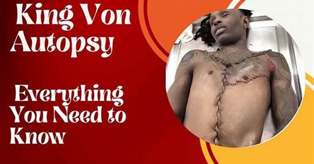 Unraveling the Mystery: King Von Autopsy and Its Implications