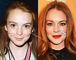 Unveiling Lindsay Lohan's Nose Job: Secrets and Revelations