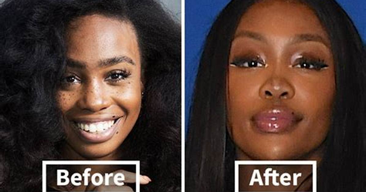 Unveiling Sza's Pre-Surgery Transformation: a Comprehensive Guide