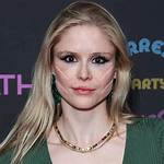 Unveiling the Secrets of Erin Moriarty's Buccal Fat Removal Transformation