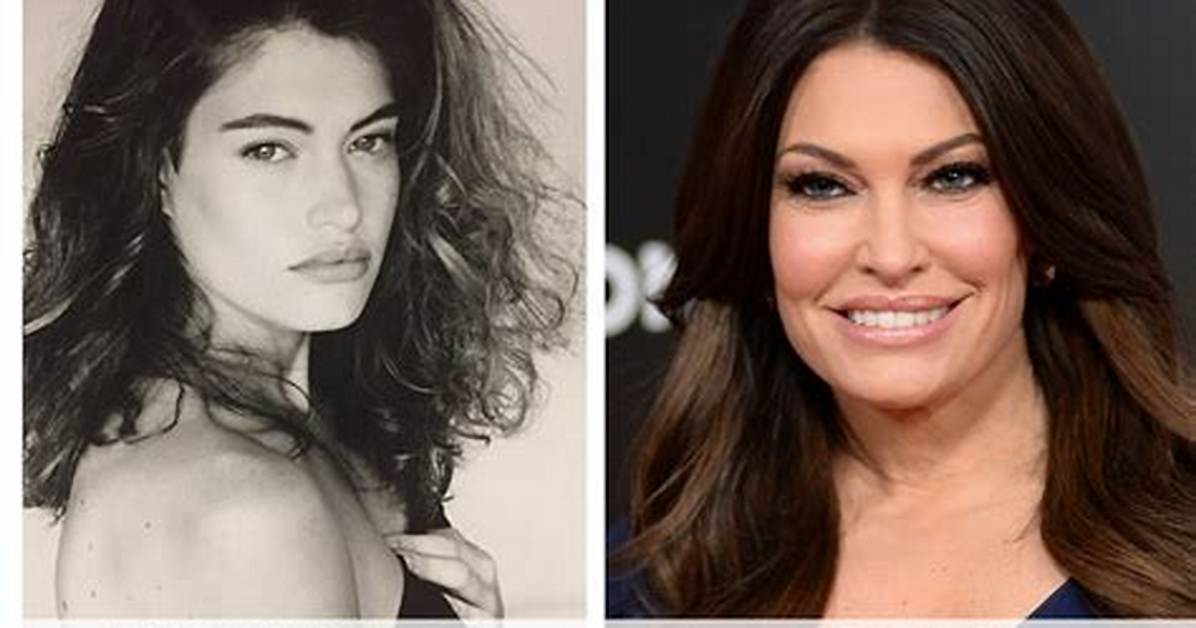 Unveiling the Transformation: Kimberly Guilfoyle Then and Now Photos