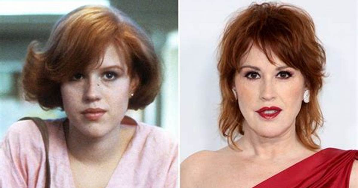 Unveiling the Truth Behind Molly Ringwald's Surgery: a Deep Dive