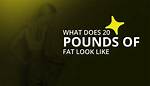 Visualizing 30 Pounds of Fat: Unveiling the Health Implications